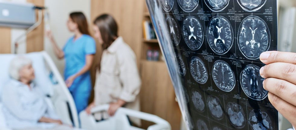 Hemorrhagic transformation is the most common safety concern in therapeutic revascularization with either IVT or EVT.