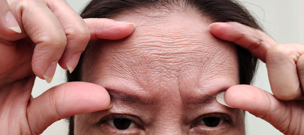 People who have a higher biological age than their actual chronological age have a significantly increased risk of stroke and dementia, especially vascular dementia. 