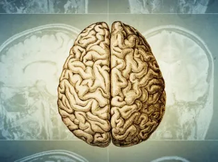 IStock 2220958371 Brain Tomography