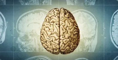 IStock 2220958371 Brain Tomography