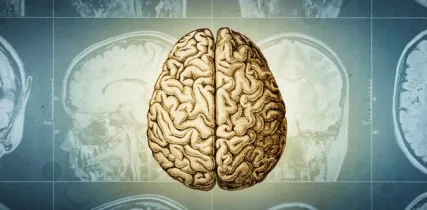 IStock 2220958371 Brain Tomography