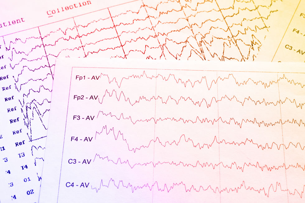 eeg results