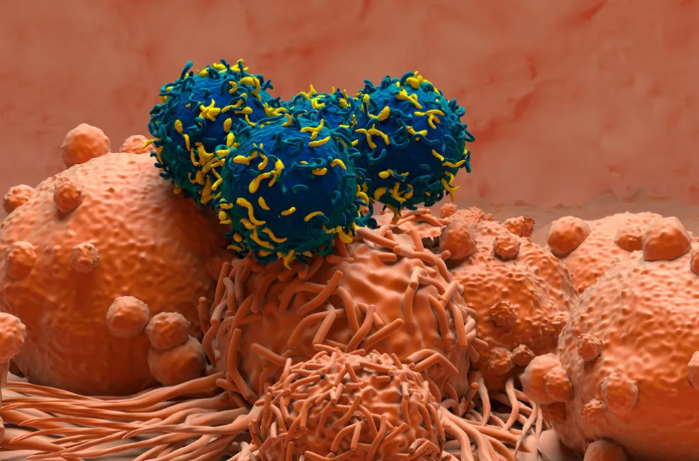 TCell Therapy