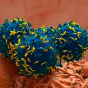 IStock 2158381942 TCell Therapy