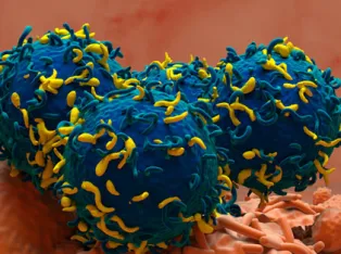 IStock 2158381942 TCell Therapy