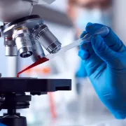 iStock 1363238207 blood test