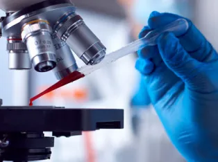 iStock 1363238207 blood test