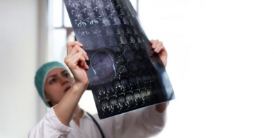 iStock 667354924 mri