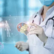 IStock 1339081030 Stroke Innovation