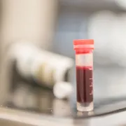 iStock 1134018691 blood sample
