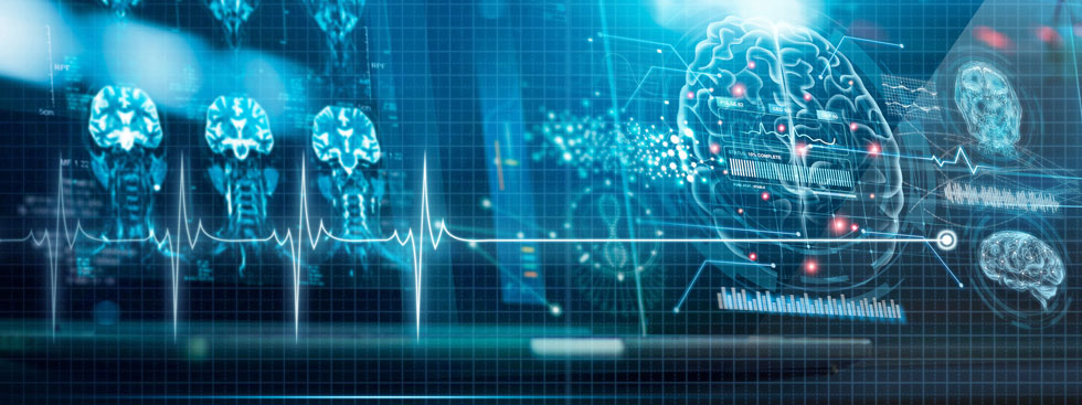 Neurological diseases as a cause of death rose significantly in all major Western countries over the last decades.