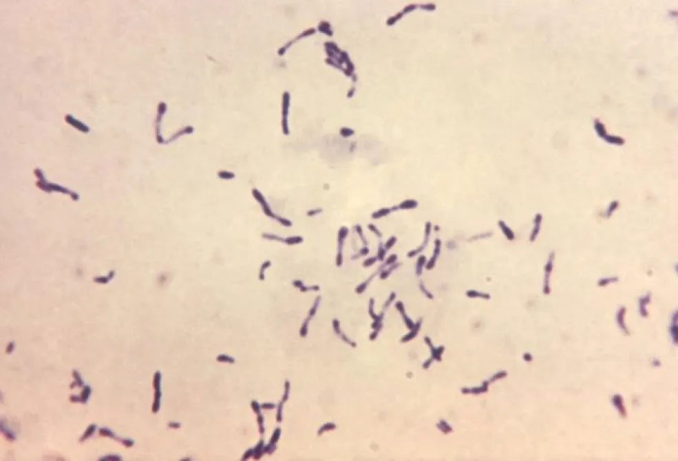 Photomicrograph Of Gram Positive Corynebacterium Diphtheriae Bacteria