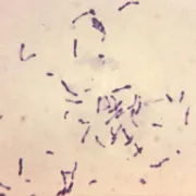 Photomicrograph Of Gram Positive Corynebacterium Diphtheriae Bacteria