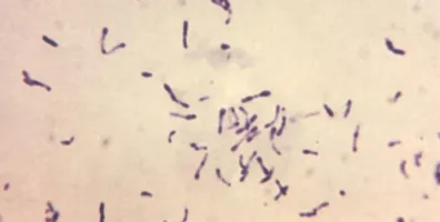 Photomicrograph Of Gram Positive Corynebacterium Diphtheriae Bacteria