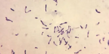 Photomicrograph Of Gram Positive Corynebacterium Diphtheriae Bacteria