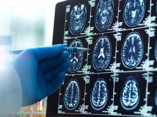 IStock 2221046819 Pointing At Brain Scans