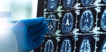 IStock 2221046819 Pointing At Brain Scans