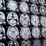 IStock 641048776 MRI Scans