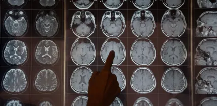 IStock 2167998369 Neuroimaging