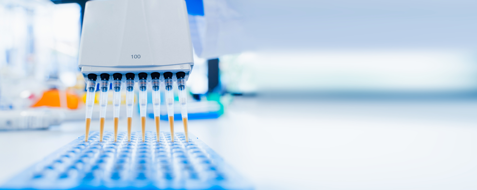 Exome sequencing of affected individuals from a large family affected with AD. PCR amplification and direct Sanger sequencing used to verify variants detected by exome analysis and to screen family members at-risk to carry those variants.