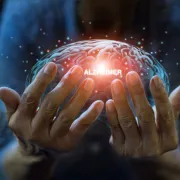 IStock 1343099797 Alzheimers