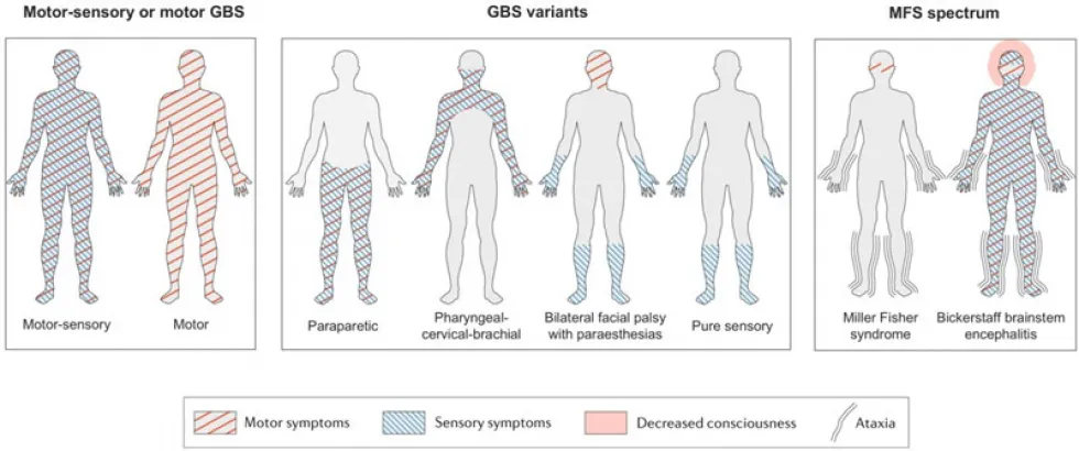 JNS Editors Choice Autoimmune Neuropathies