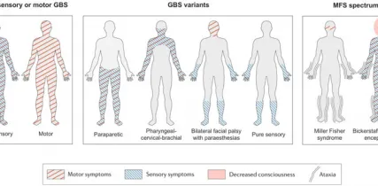 JNS Editors Choice Autoimmune Neuropathies