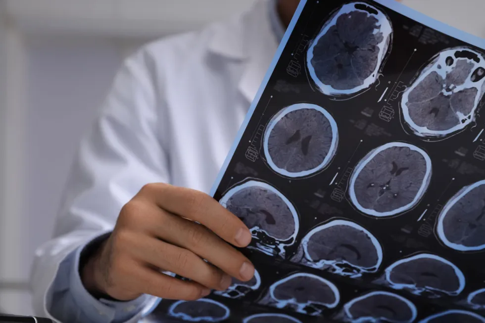 Brain Scan Sheet