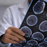 IStock 1423600449 Brain Scan Sheet