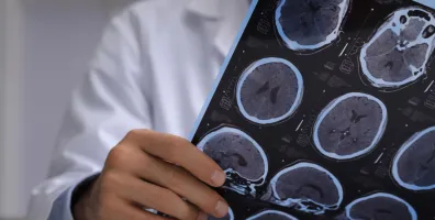 IStock 1423600449 Brain Scan Sheet
