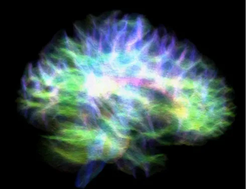 High-resolution image of the ‘wiring diagram’ of a human brain revealing connections to the hippocampus