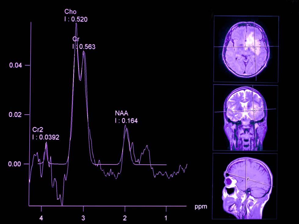 memoranda neurology